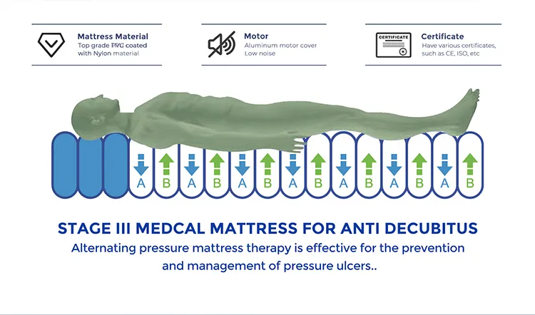 hospital air mattress for bedsores